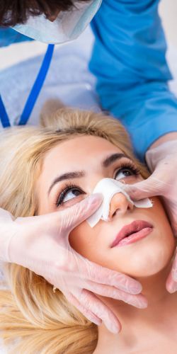 rinoplastia-sin-cirujia-002