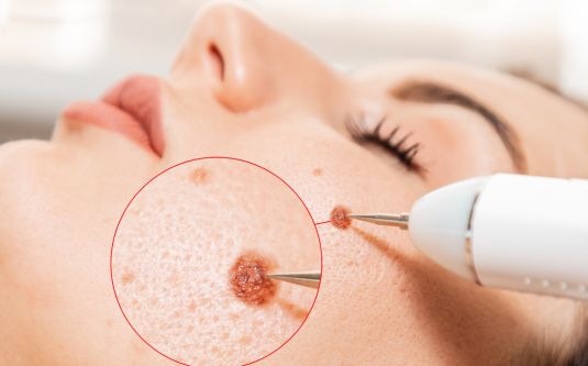 terapia-de-celulas-madre-001