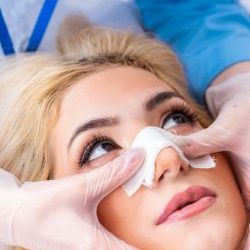 rinoplastia-sin-cirujia-002